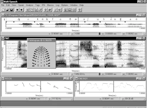 KOZMIQPRINT™ Acoustic Analysis Software - Kay Pentax Multi-Speech Model 3700